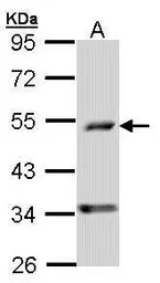 Anti-PDSS2 antibody [N2C3] used in Western Blot (WB). GTX104912