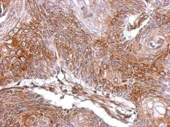 Anti-Elastase 3A antibody used in IHC (Paraffin sections) (IHC-P). GTX104918