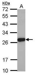 Anti-Elastase 3A antibody used in Western Blot (WB). GTX104918