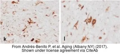 Anti-HLA-DRB1 antibody [N1C3] used in Immunohistochemistry (IHC). GTX104919