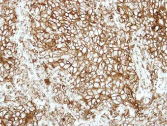 Anti-HLA-DRB1 antibody [N1C3] used in IHC (Paraffin sections) (IHC-P). GTX104919