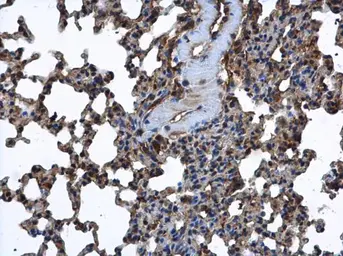 Anti-FARSLA antibody [N2C2], Internal used in IHC (Paraffin sections) (IHC-P). GTX104924