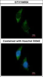 Anti-FARSLA antibody [N2C2], Internal used in Immunocytochemistry/ Immunofluorescence (ICC/IF). GTX104924