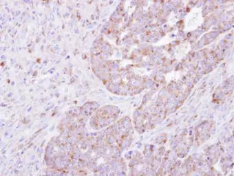 Anti-FARSLA antibody [N2C2], Internal used in IHC (Paraffin sections) (IHC-P). GTX104924