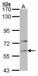 Anti-FARSLA antibody [N2C2], Internal used in Western Blot (WB). GTX104924