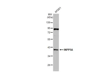 Anti-INPP5A antibody [N2C3] used in Western Blot (WB). GTX104929