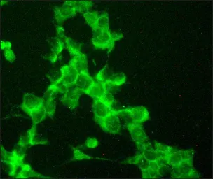 Anti-p75 NGF Receptor / CD271 antibody used in Immunocytochemistry/ Immunofluorescence (ICC/IF). GTX10494