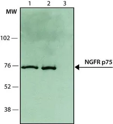 Anti-p75 NGF Receptor / CD271 antibody used in Western Blot (WB). GTX10494