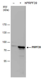 Anti-PRPF39 antibody [N2C1], Internal used in Western Blot (WB). GTX104949