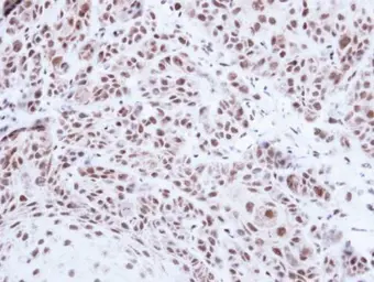 Anti-PRPF39 antibody [N2C1], Internal used in IHC (Paraffin sections) (IHC-P). GTX104949