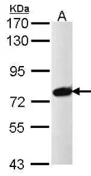 Anti-PRPF39 antibody [N2C1], Internal used in Western Blot (WB). GTX104949