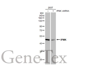 Anti-IPMK antibody [N1C2] used in Western Blot (WB). GTX104954