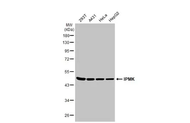 Anti-IPMK antibody [N1C2] used in Western Blot (WB). GTX104954