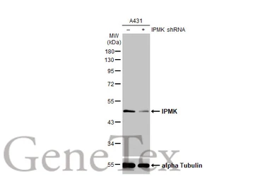 Anti-IPMK antibody [N1C2] used in Western Blot (WB). GTX104954