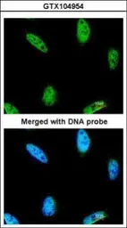 Anti-IPMK antibody [N1C2] used in Immunocytochemistry/ Immunofluorescence (ICC/IF). GTX104954