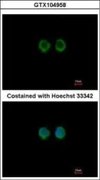Anti-MOK antibody [N2C3] used in Immunocytochemistry/ Immunofluorescence (ICC/IF). GTX104958