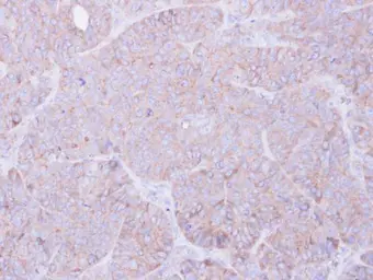 Anti-MOK antibody [N2C3] used in IHC (Paraffin sections) (IHC-P). GTX104958
