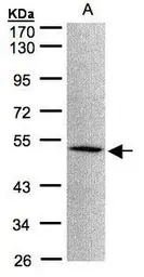 Anti-MOK antibody [N2C3] used in Western Blot (WB). GTX104958