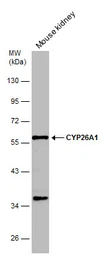 Anti-CYP26A1 antibody used in Western Blot (WB). GTX104961