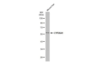 Anti-CYP26A1 antibody used in Western Blot (WB). GTX104961
