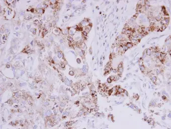 Anti-MTHFD2 antibody [N1C3] used in IHC (Paraffin sections) (IHC-P). GTX104990