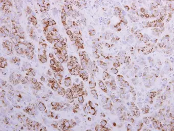 Anti-MTHFD2 antibody [N1C3] used in IHC (Paraffin sections) (IHC-P). GTX104990