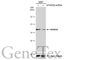 Anti-MTHFD2 antibody [N1C3] used in Western Blot (WB). GTX104990