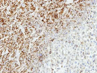 Anti-MTHFD2 antibody [N1C3] used in IHC (Paraffin sections) (IHC-P). GTX104990