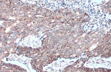Anti-MTHFD2 antibody [N1C3] used in IHC (Paraffin sections) (IHC-P). GTX104990