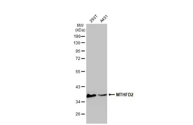 Anti-MTHFD2 antibody [N1C3] used in Western Blot (WB). GTX104990