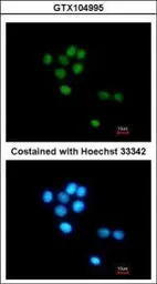 Anti-TULP3 antibody [N2C3] used in Immunocytochemistry/ Immunofluorescence (ICC/IF). GTX104995