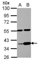 Anti-LUZP4 antibody [N1C3] used in Western Blot (WB). GTX105002