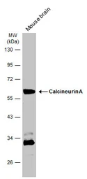 Anti-Calcineurin A antibody used in Western Blot (WB). GTX105003