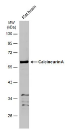 Anti-Calcineurin A antibody used in Western Blot (WB). GTX105003