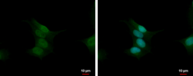 Anti-Calcineurin A antibody used in Immunocytochemistry/ Immunofluorescence (ICC/IF). GTX105003