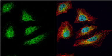 Anti-CDC34 antibody [N1C3] used in Immunocytochemistry/ Immunofluorescence (ICC/IF). GTX105013