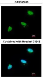 Anti-CDC34 antibody [N1C3] used in Immunocytochemistry/ Immunofluorescence (ICC/IF). GTX105013