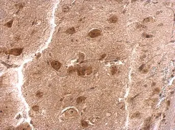 Anti-RPS3A antibody used in IHC (Paraffin sections) (IHC-P). GTX105020