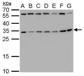 Anti-RPS3A antibody used in Western Blot (WB). GTX105020
