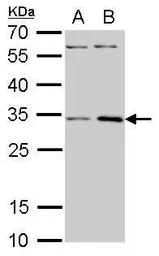 Anti-RPS3A antibody used in Western Blot (WB). GTX105020