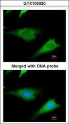 Anti-RPS3A antibody used in Immunocytochemistry/ Immunofluorescence (ICC/IF). GTX105020