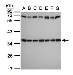 Anti-RPS3A antibody used in Western Blot (WB). GTX105020