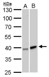 Anti-GALK1 antibody [N3C3] used in Western Blot (WB). GTX105024