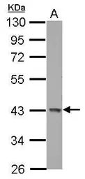 Anti-GALK1 antibody [N3C3] used in Western Blot (WB). GTX105024