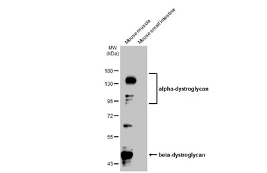 Anti-DAG1 antibody used in Western Blot (WB). GTX105038