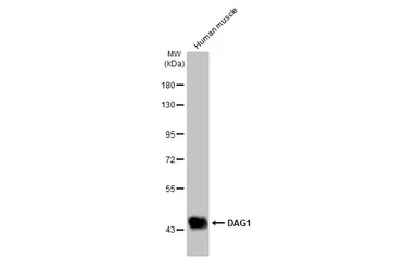 Anti-DAG1 antibody used in Western Blot (WB). GTX105038