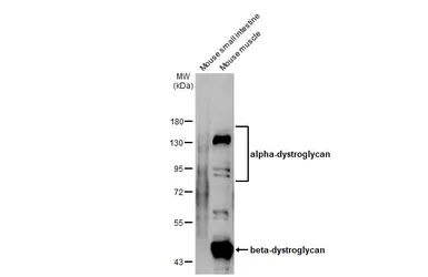 Anti-DAG1 antibody used in Western Blot (WB). GTX105038