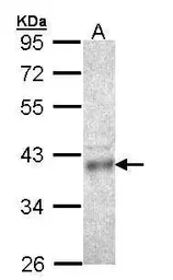Anti-CPOX antibody [N2C3] used in Western Blot (WB). GTX105056