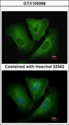 Anti-HLA-DRB3 antibody used in Immunocytochemistry/ Immunofluorescence (ICC/IF). GTX105068