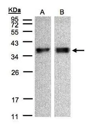 Anti-ZPBP antibody used in Western Blot (WB). GTX105073
